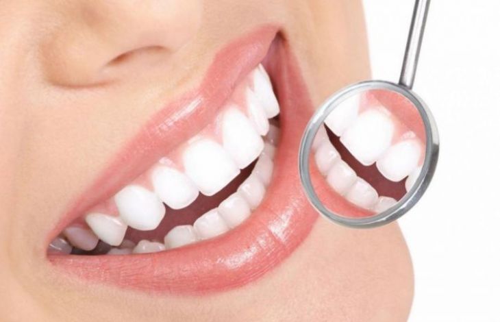 Metode naturale de inlaturare a tartrului dentar