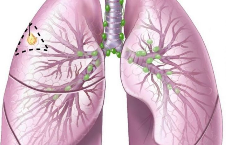 Cum sa-ti maresti capacitatea pulmonara