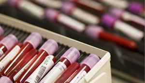 Cum sa te pregatesti pentru recoltarea analizelor de sange