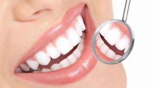 Metode naturale de inlaturare a tartrului dentar