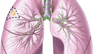 Cum sa-ti maresti capacitatea pulmonara