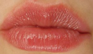 5 solutii eficiente pentru vindecarea buzelor umflate