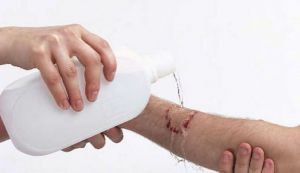Cum se curata taieturile